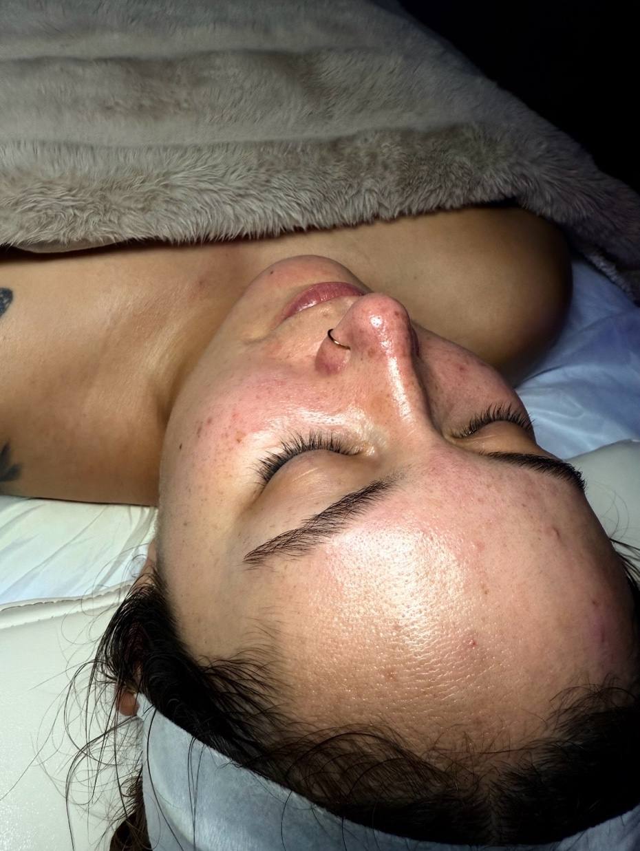 Facial treatment results glowing skin San Diego